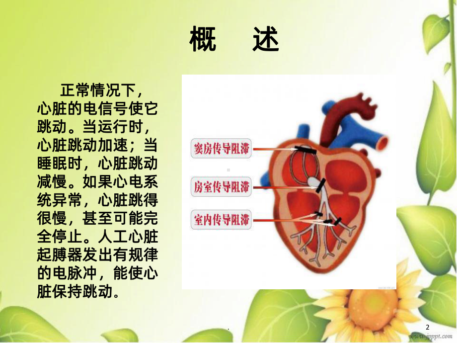 心脏永久起搏器植入术的护理课件.ppt_第2页