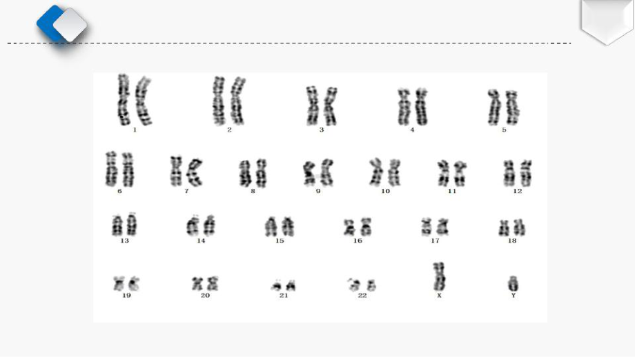 胎儿染色体异常的超声诊断课件.pptx_第3页