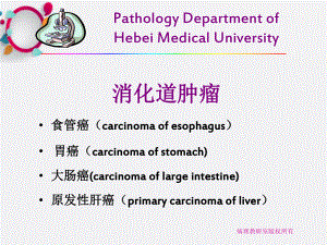 《消化系统常见肿瘤》课件.ppt