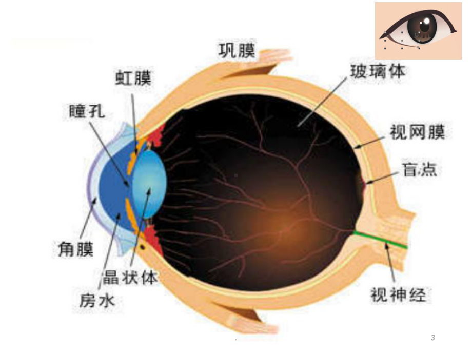 角膜移植的护理课件.ppt_第3页