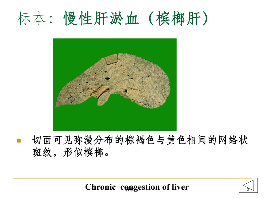 病理学实验大体标本+有病理诊断课件.ppt_第2页