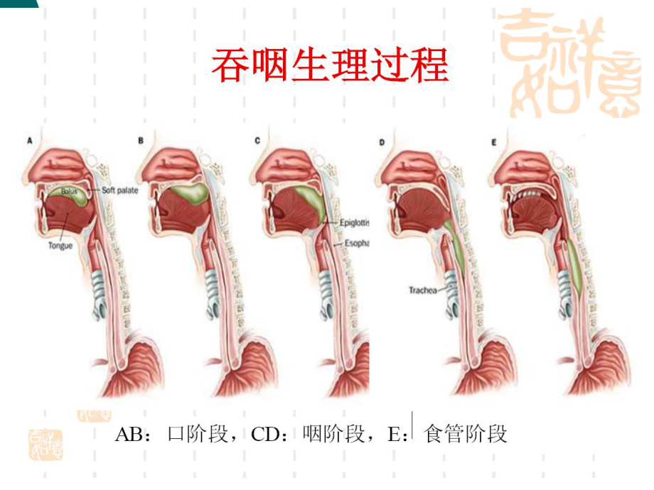 吞咽功能评估课件.ppt_第2页