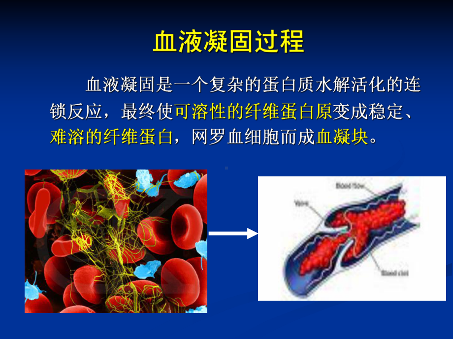 血液系统药物课件.ppt_第2页