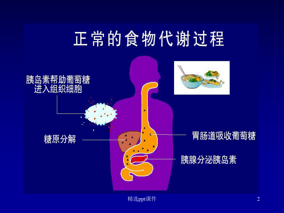 《糖尿病饮食管理》课件.ppt_第2页