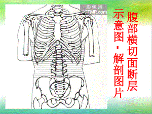 腹部断层解剖和断层CT(上)课件.ppt