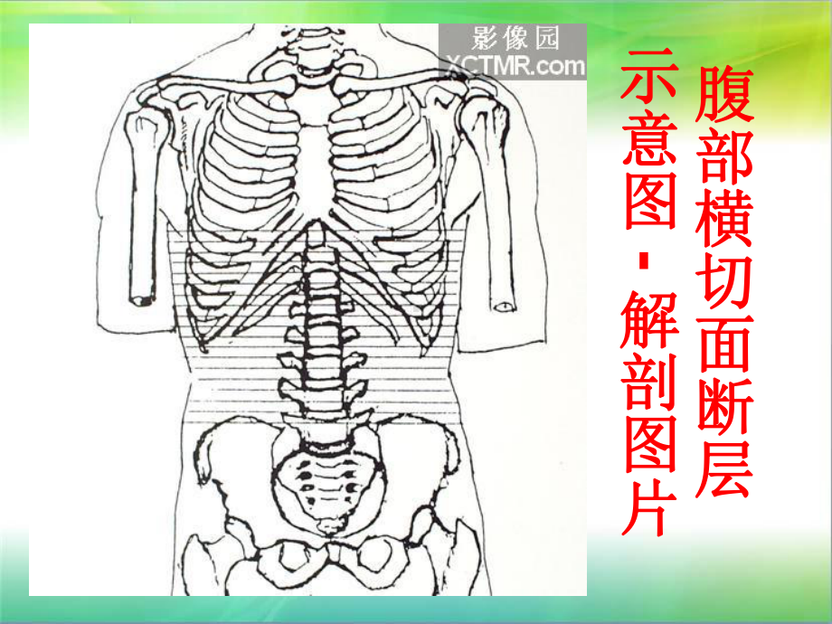 腹部断层解剖和断层CT(上)课件.ppt_第1页