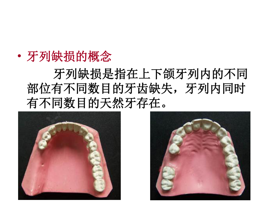 口腔修复学资料课件.ppt_第3页