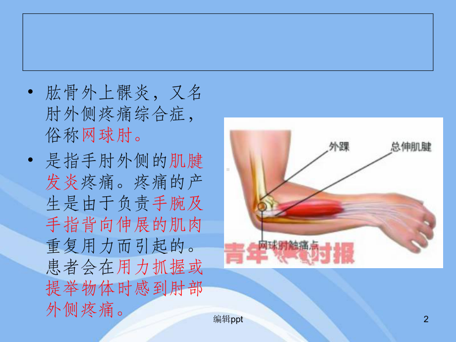 肱骨外上髁炎41880课件.ppt_第2页