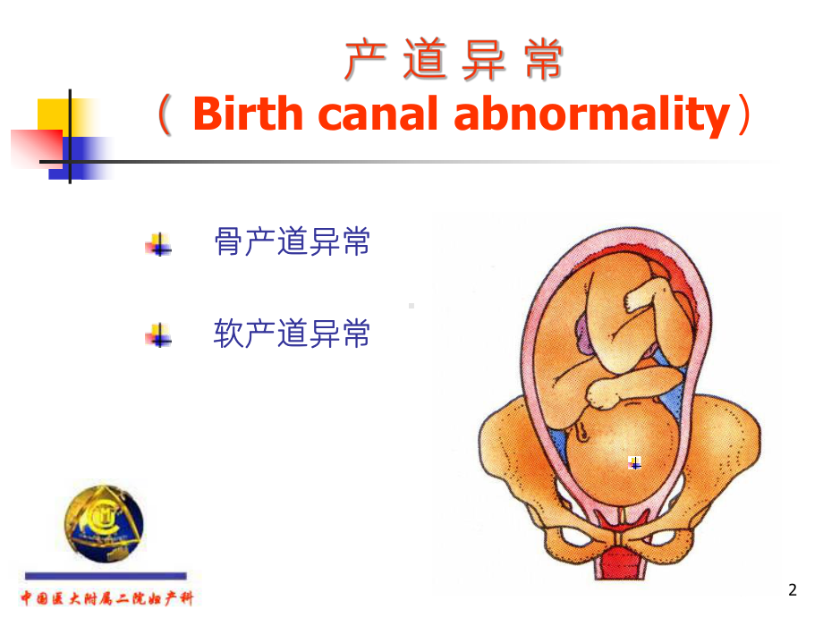 《产道异常》课件.ppt_第2页