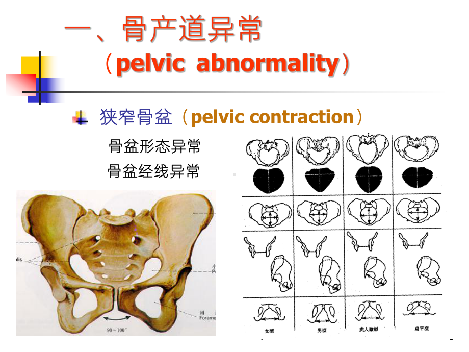 《产道异常》课件.ppt_第3页