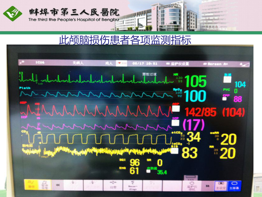 重症脑损伤患者的镇痛镇静治疗课件.ppt_第3页