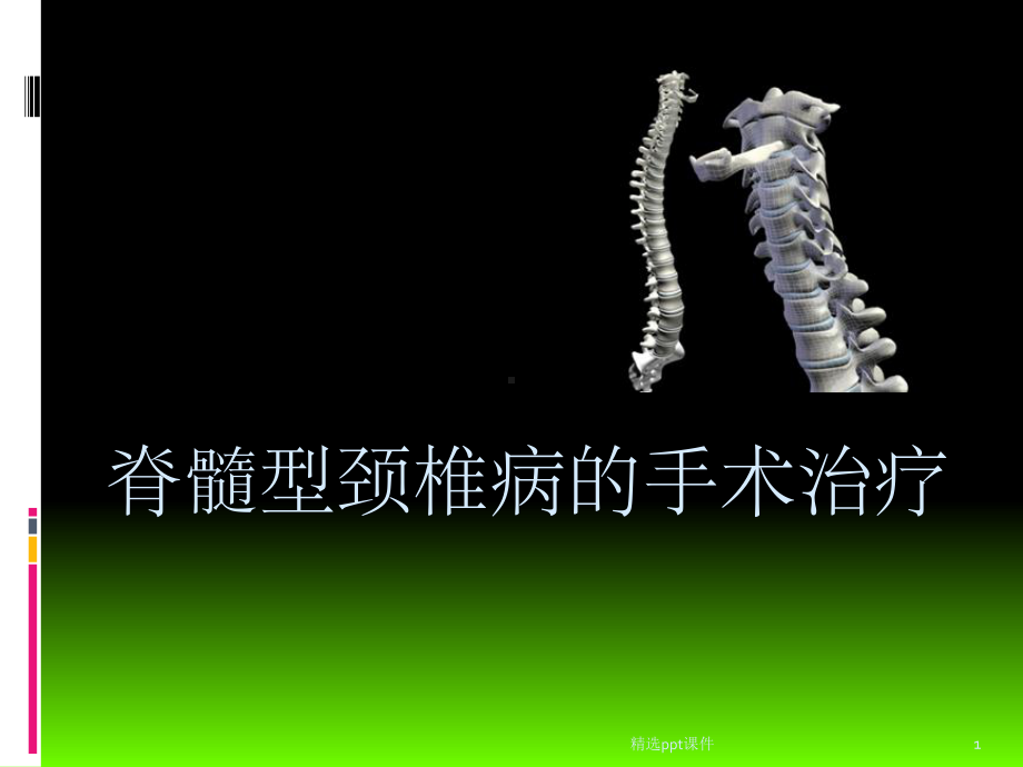 《颈椎病的手术治疗》课件.ppt_第1页