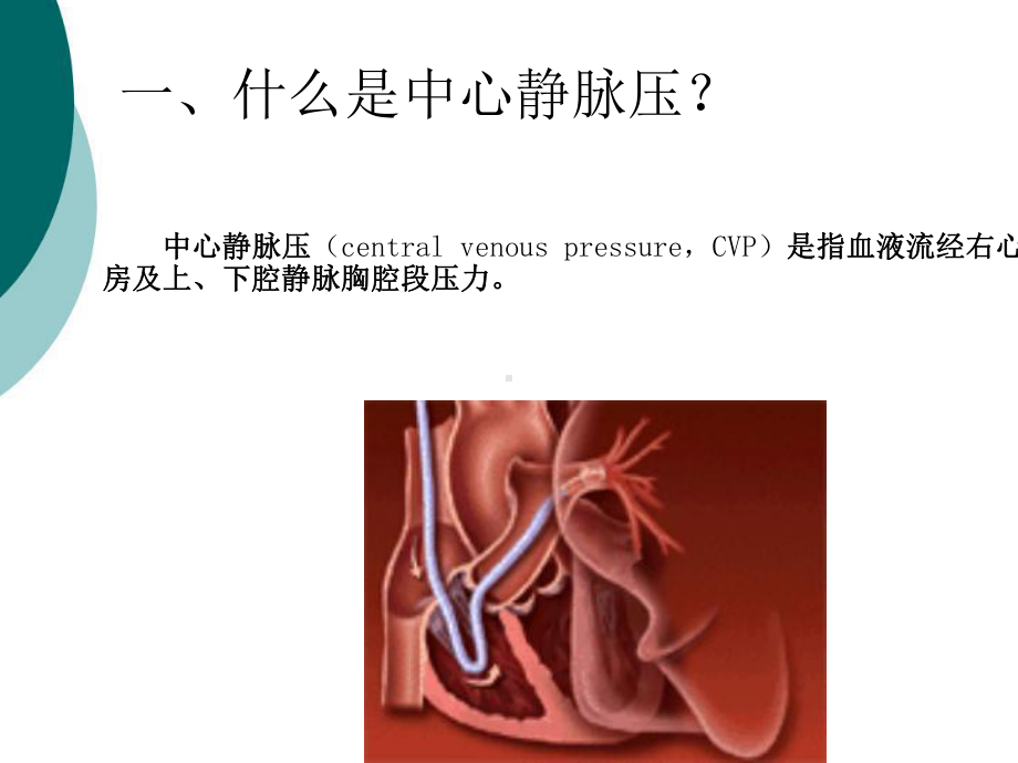 中心静脉压CVP的监测和护理课件.ppt_第3页