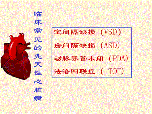 部分先天性心脏病课件.ppt