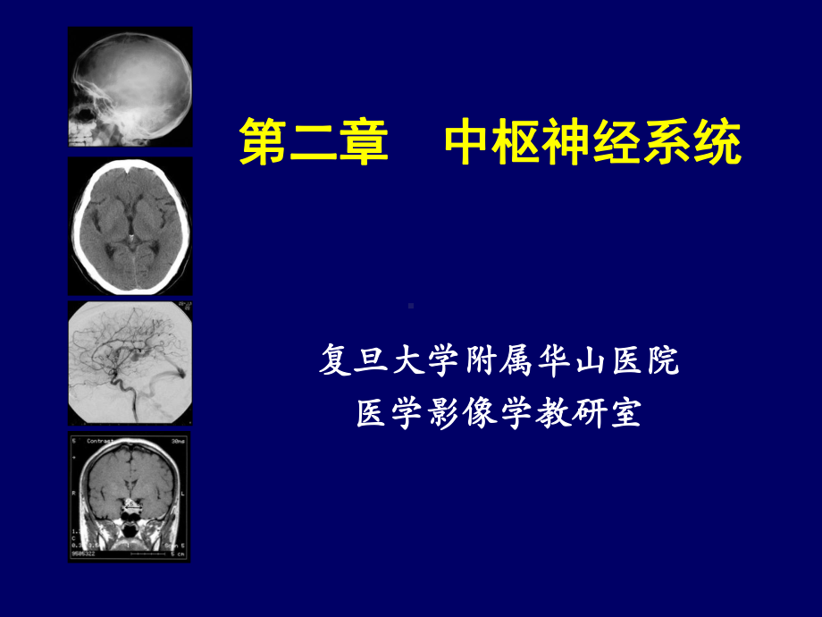 住院医师培训-中枢神经系统影像学课件.ppt_第2页