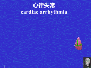 arrhythmia(心律失常)英文版课件.ppt