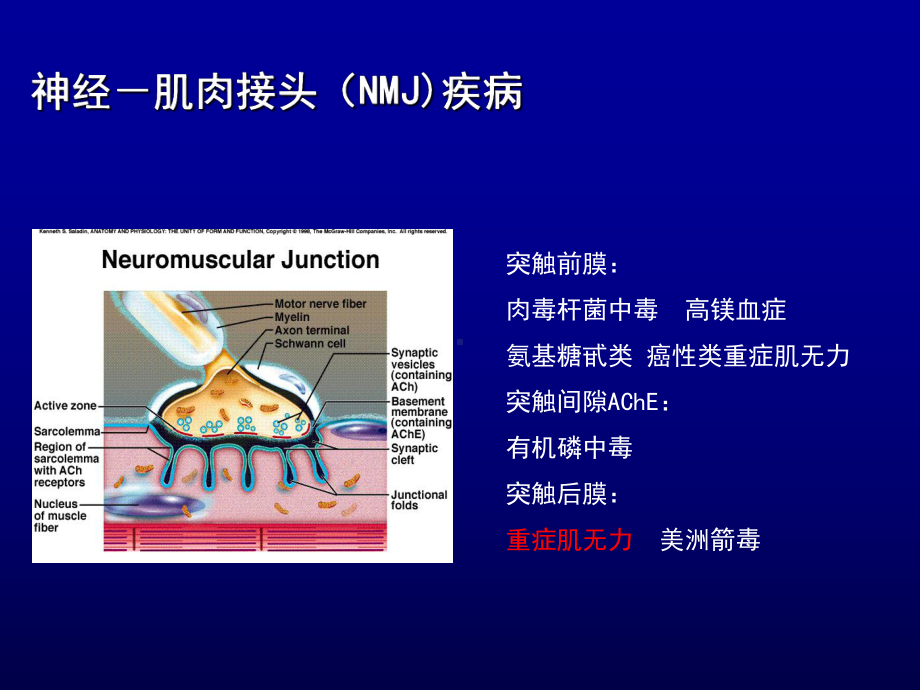 重症肌无力及周期性麻痹课件.ppt_第3页