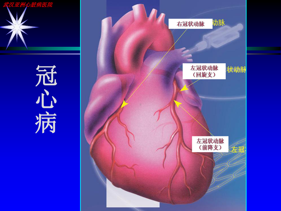 冠心病康复治疗及指导课件.pptx_第1页