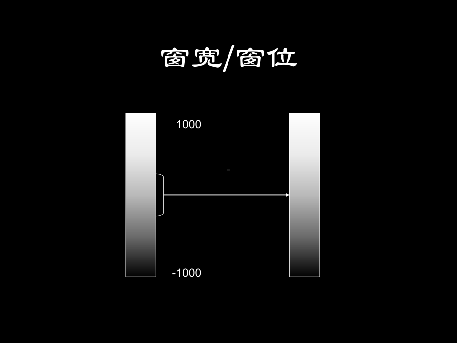 神经系统影像基础读片修课件.ppt_第3页