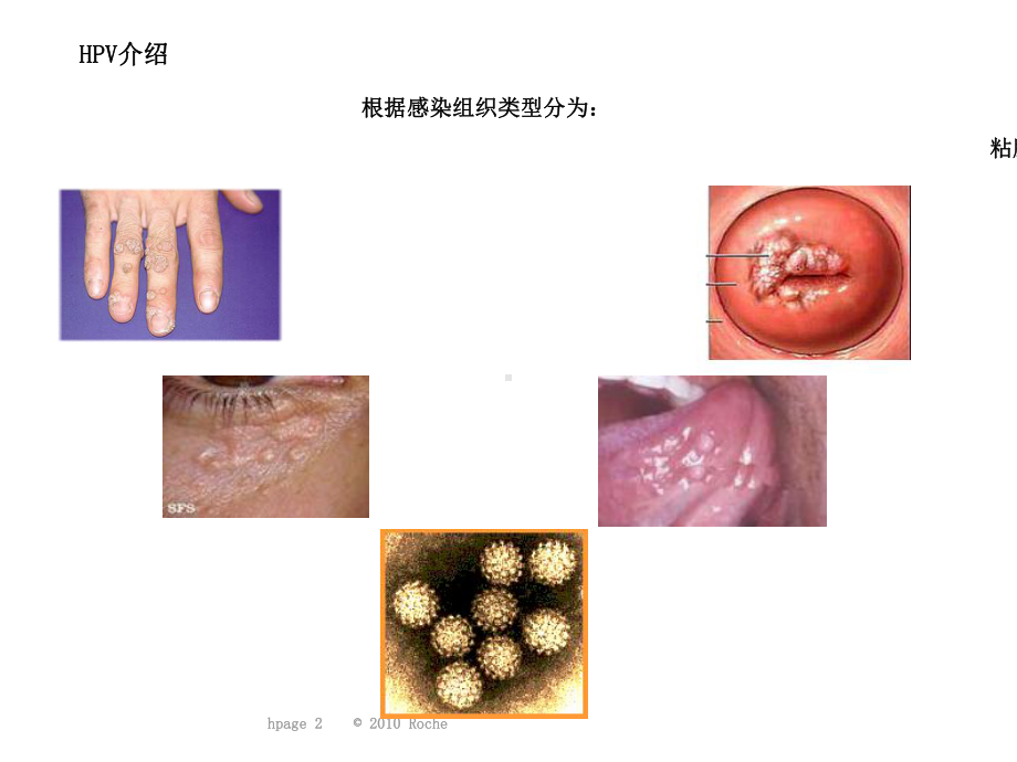 HPVDNA检测现状及最新国际宫颈癌筛查课件.ppt_第3页