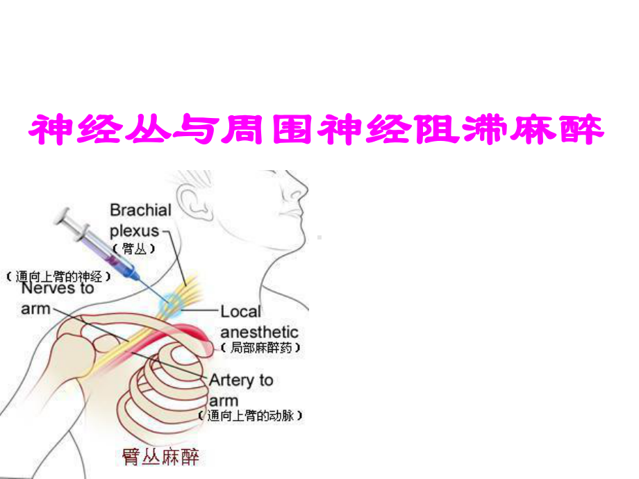 讲课稿：周围神经阻滞麻醉课件.ppt_第1页