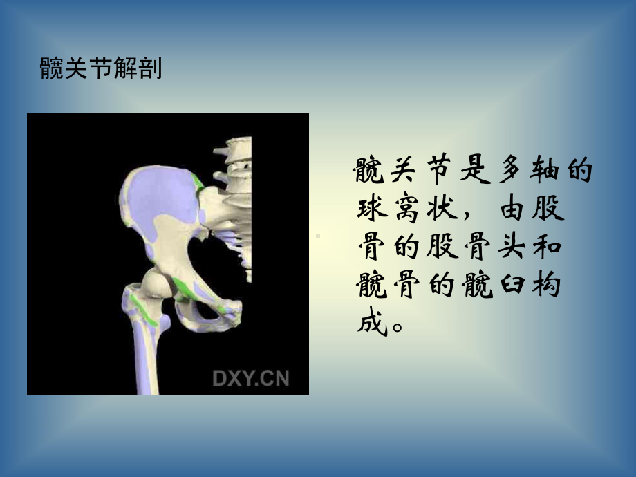 髋关节及其常见病课件.ppt_第3页