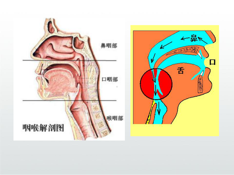 咽炎病人的护理课件.ppt_第3页