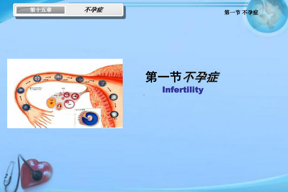 不孕症及辅助生殖技术(含特效)-课件.ppt_第2页