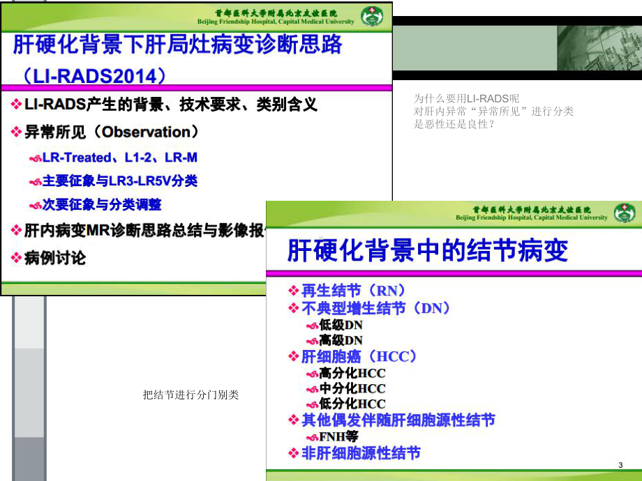 肝硬化背景下局限性结节病变的MR诊断思路课件.ppt_第3页