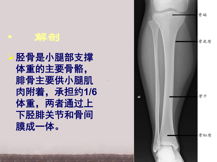 胫腓骨骨折围手术期的护理-课件.ppt_第3页