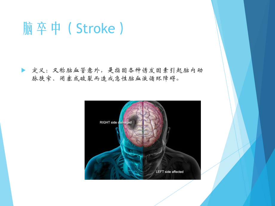 脑卒中的症状和定位课件.ppt_第3页