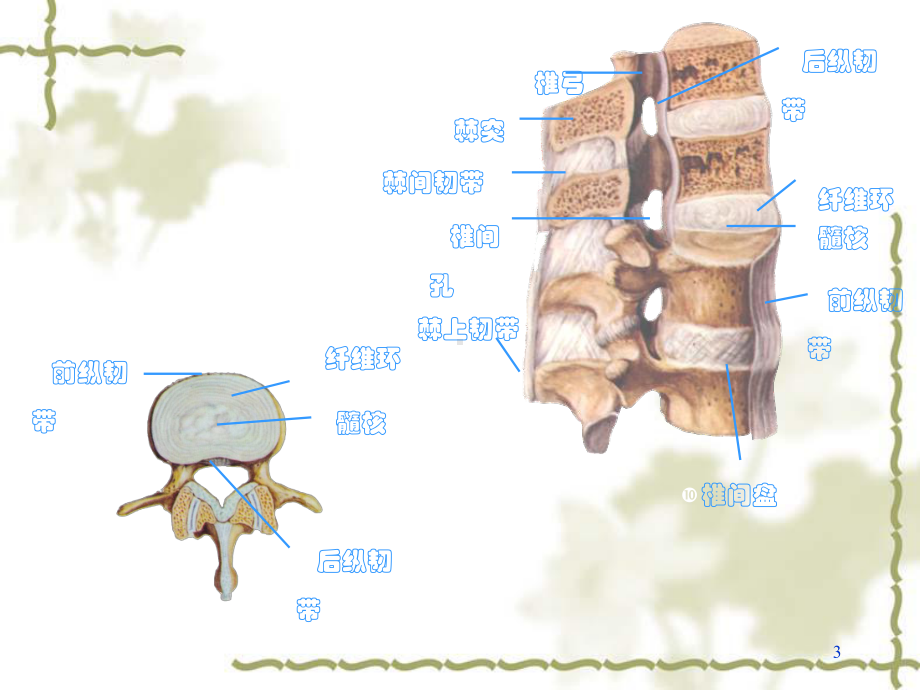 腰椎间盘突出症微创介入治疗4课件.ppt_第3页