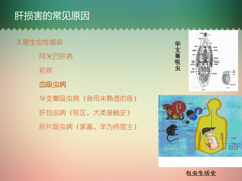 造成肝损害的少见病课件.ppt_第3页