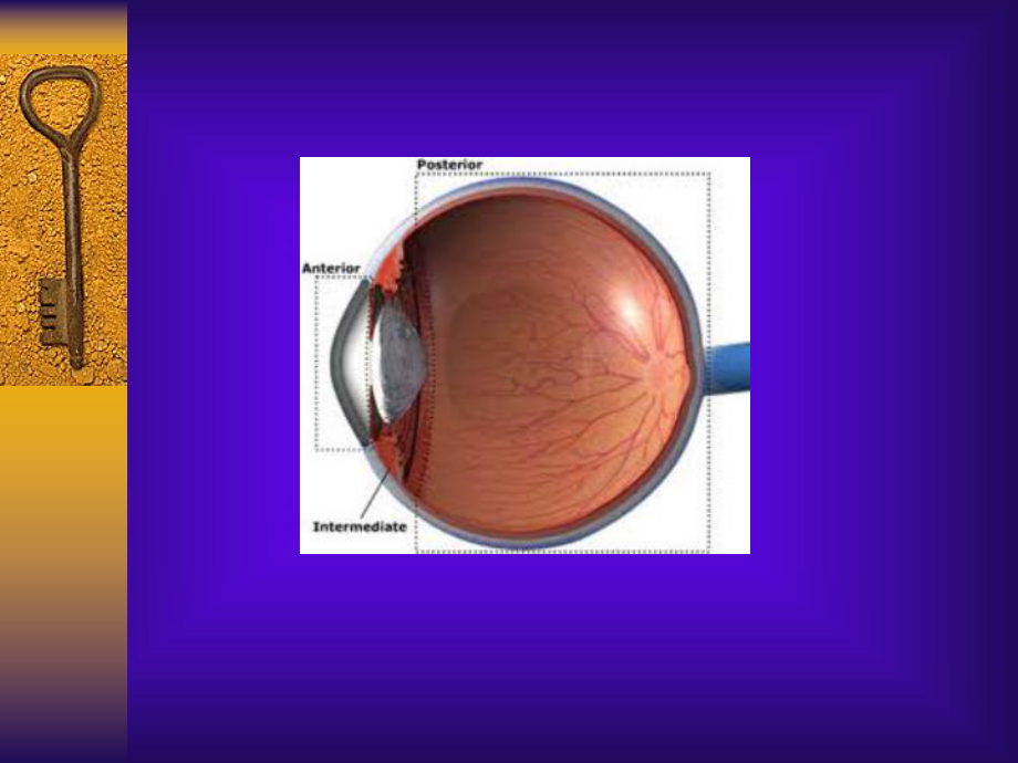 眼科学5葡萄膜课件.ppt_第3页