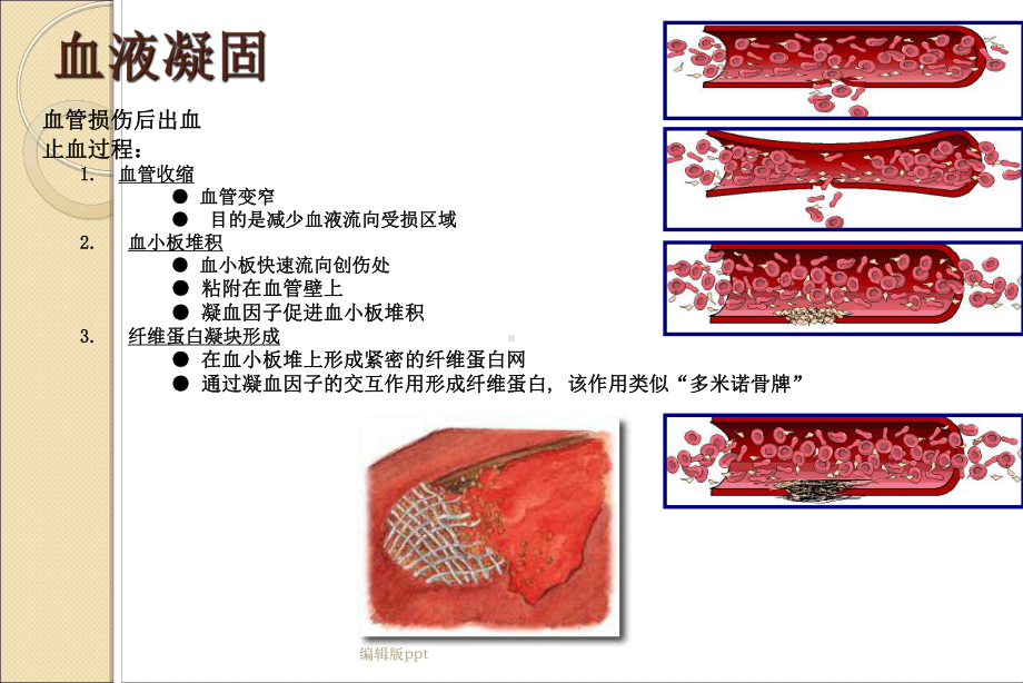 血小板GPIIbIIIa受体拮抗剂课件.ppt_第3页