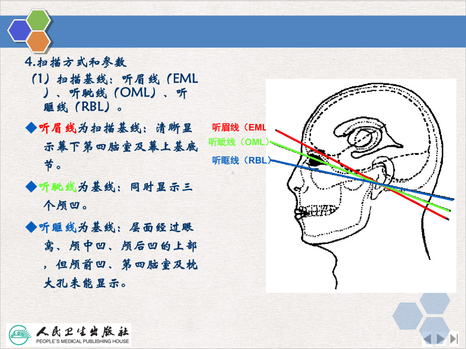 颅脑CT检查技术课件.pptx_第3页