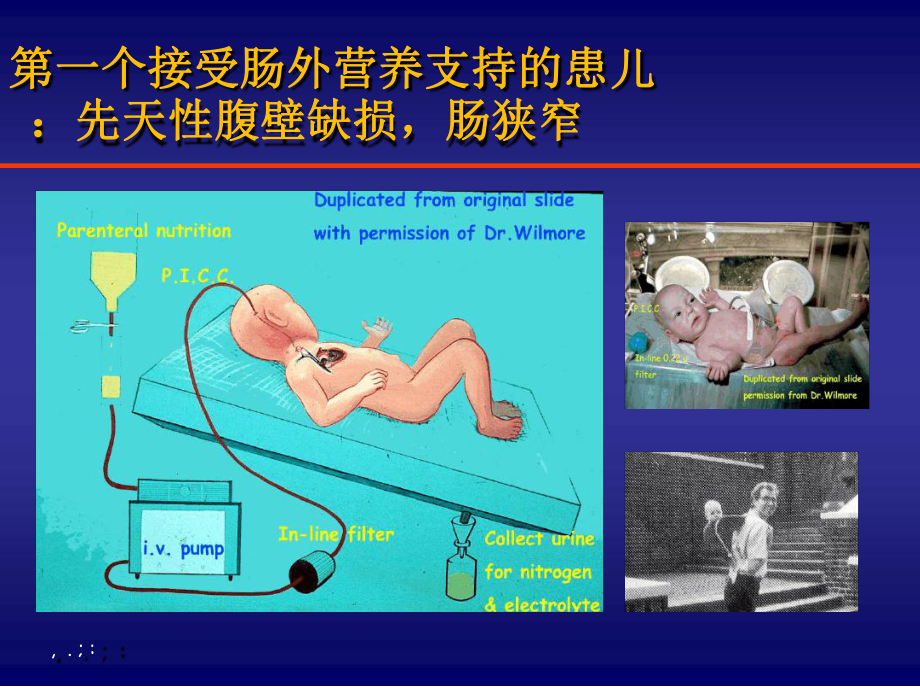 规范化的肠外营养支持课件.ppt_第3页