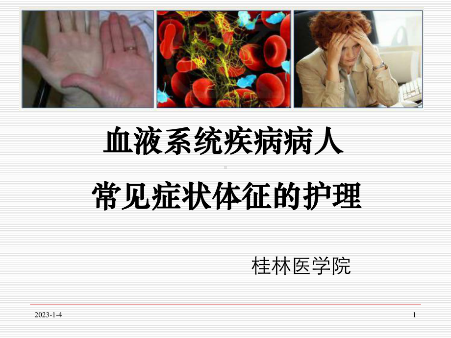 血液科疾病常见症状-护理课件.ppt_第1页