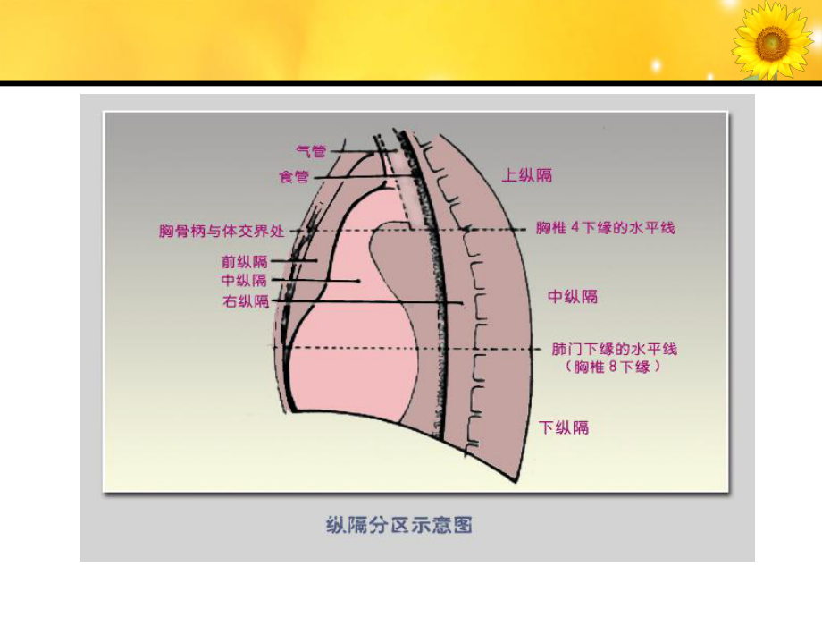 纵膈肿瘤影像诊断(同名98)课件.ppt_第3页