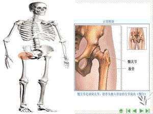 髋关节置换术护理课件.pptx