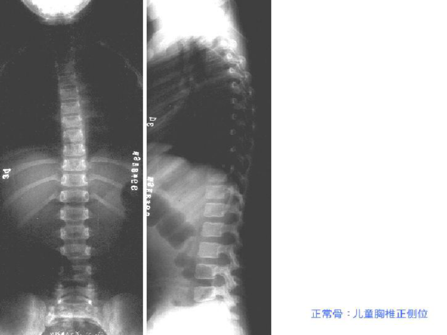 骨与关节基本病理表现教学课件.pptx_第3页