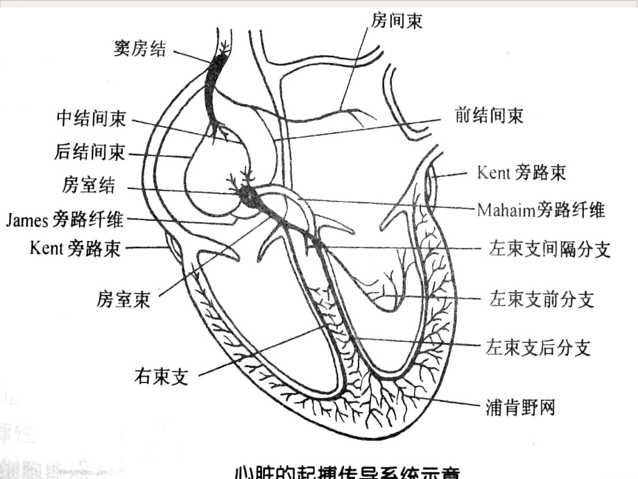 病窦综合征的护理实用课件.pptx_第2页