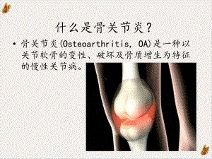 骨关节炎与骨质疏松症课件.pptx