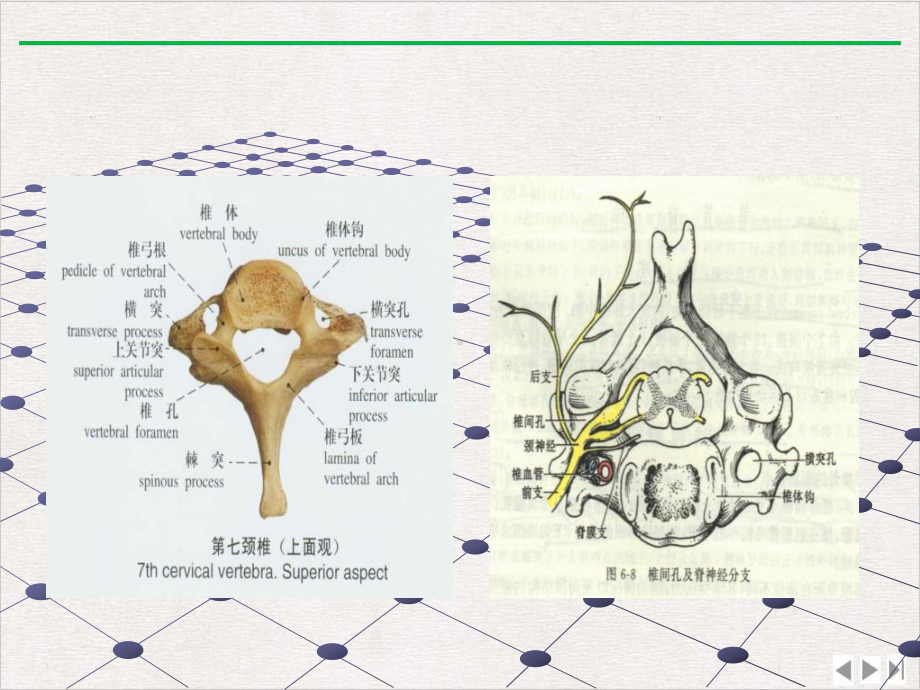 神经根型颈椎病的诊断课件完整版.pptx_第3页