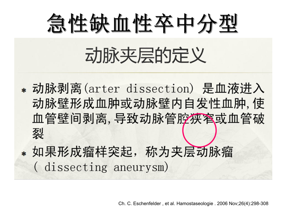 颈动脉夹层治疗策略课件.pptx_第3页