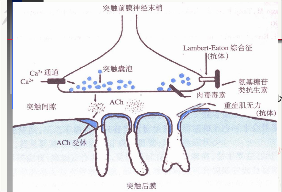 神经病学教学重症肌无力中文PPT课件.pptx_第2页