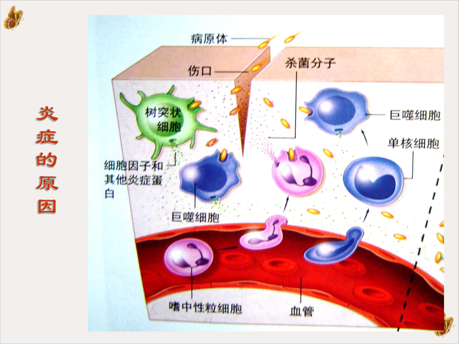 非甾体抗炎药和糖皮质激素课件.pptx_第1页