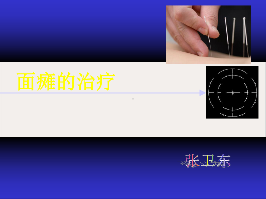 面瘫的治疗课件.ppt_第1页