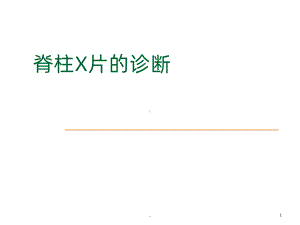 脊柱x片诊断课件.ppt