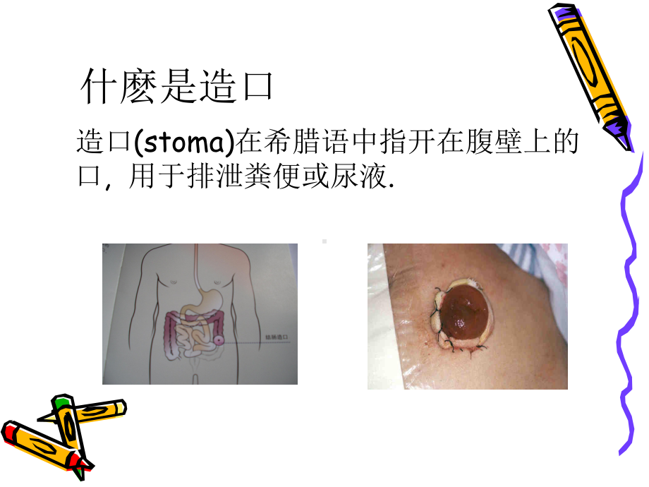 造口护理选编课件.ppt_第2页